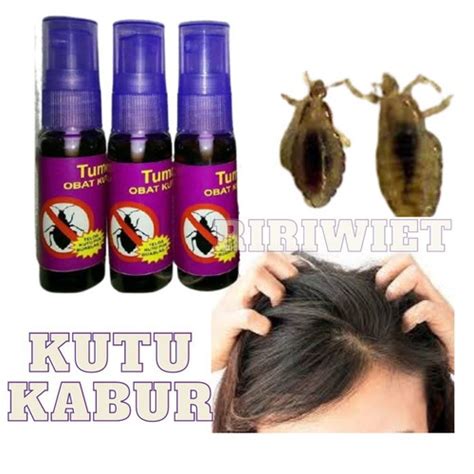 Jual Spray Obat Untuk Menghilangkan Kutu Rambut Dan Telurnya Di Kepala