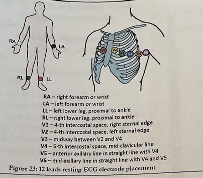 Med Surg Exam Flashcards Quizlet