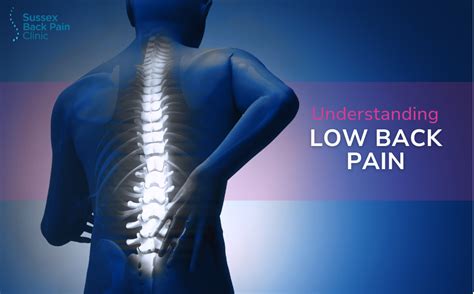 Low Back Pain Sussex Back Pain Clinic