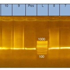 Agarose Gel Showing Polymerase Chain Reaction Pcr Amplified Product