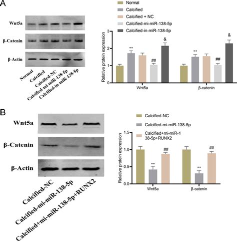 Effect of miR 138 5p targeting RUNX2 on Wnt β catenin signaling