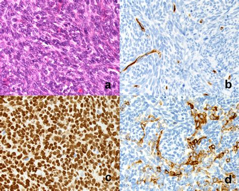 Histology A Photomicrograph Shows Histopathological Features Of