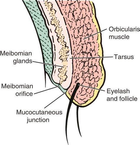 Diagnosis And Treatment Of Entropion Clinical Tree