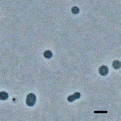 Phase-contrast microscopy image of strain T7324. Scale bar: 2 μm. The ... 