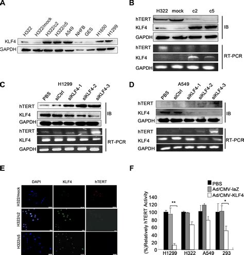 Klf4 Negatively Regulated Htert Expression In Lung Cancer Cell Lines Download Scientific