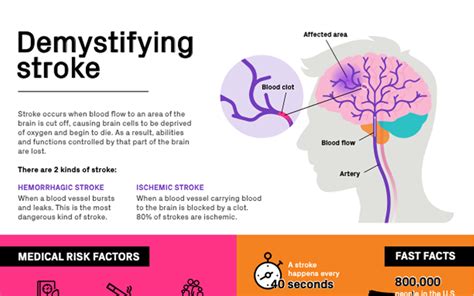 Demystifying Stroke Infographic Constant Therapy