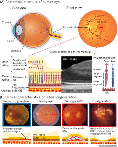 Strategies Of Pluripotent Stem Cell Based Therapy For Retinal