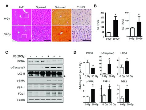 Radiation Induced Liver Injury And Fgl1 Expression A Representative