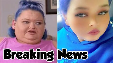 Breaking News 1000 Lb Sisters Amy Slaton Flaunts Much Thinner Face In