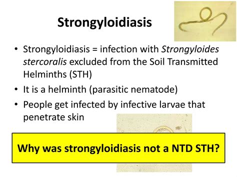 Don T Neglect The Ntds Ppt