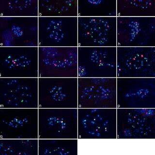 Fluorescence In Situ Hybridization FISH With Probes For 45S RDNA