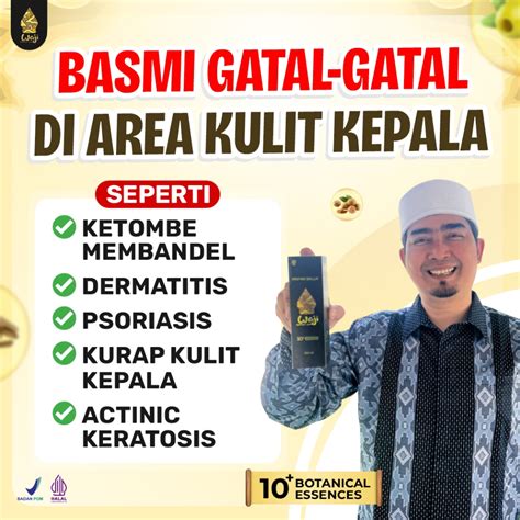 Jual Minyak Waji Basmi Gatal Di Area Kulit Kepala Ketombe Membandel