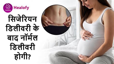 Cesarean Delivery Ke Baad Normal Delivery Ho Sakti Hai Kya VBAC