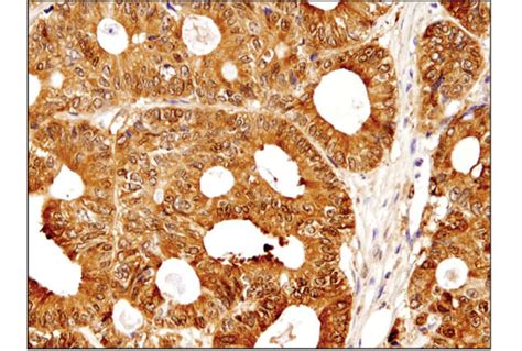 Galectin 3 LGALS3 D4I2R XP Rabbit MAb Cell Signaling Technology