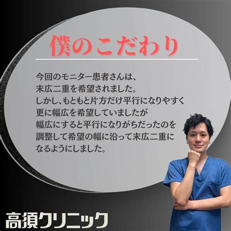 高須クリニック名古屋院さんのインスタグラム写真 高須クリニック名古屋院instagram「dr笠井による【二重埋没法】 施術前 ︎3ヶ月後 今回のモニター患者さんは、末広二重を