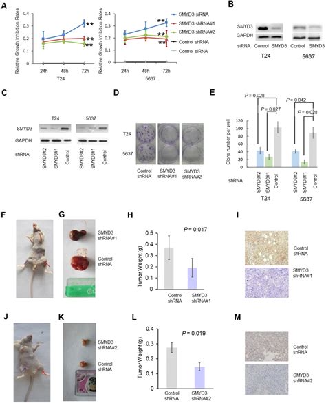 High Expression Of Smyd3 Indicates Poor Survival Outcome And Promotes