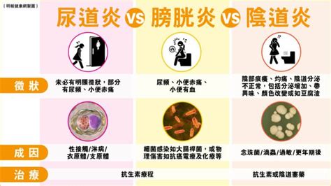 陰道炎、尿道炎、膀胱炎 女性3種常見炎症成因與徵狀 置之不理或引發不育、宮外孕等併發症？ 明報健康網