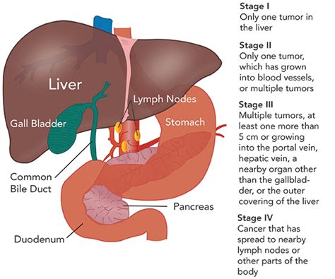 Why And When To Do Liver Cancer Test