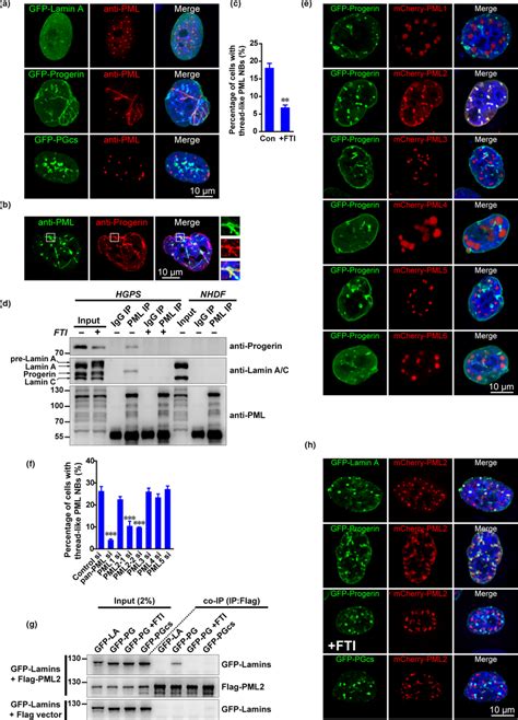 Progerin Interacts With Pml To Induce Threadlike Pml Nbs A