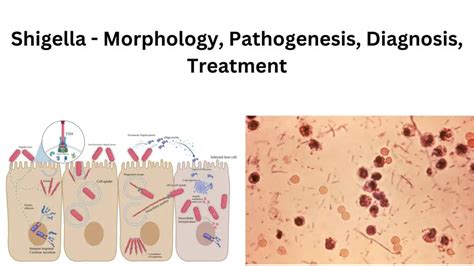 Shigella - Morphology, Pathogenesis, Diagnosis, Treatment - Biology ...