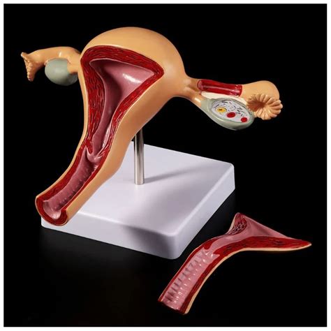 Buy Human Pathological Uterus Ovary Model Anatomical Model Of Female