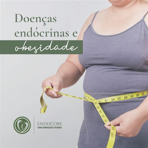 Doenças Endócrinas E Obesidade Endocore