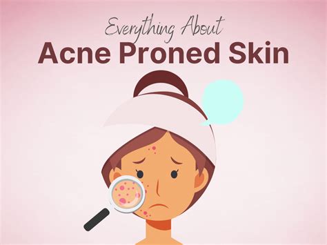 Acne Proned Skin What Should You Do