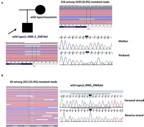 Frontiers Gene Panel Analysis In A Large Cohort Of Patients With