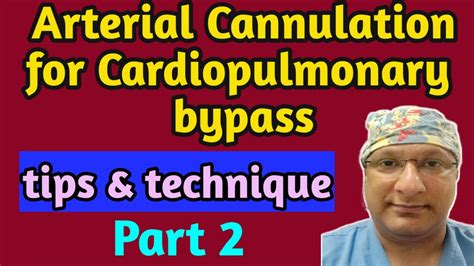 Arterial Cannulation For Cardiopulmonary Bypass Tips And Technique [ Part 2] Youtube