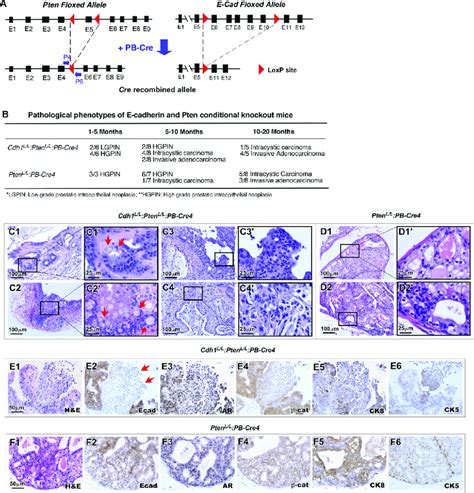 E Cadherin Pten Bigenic Knockout Results In Increased Invasion