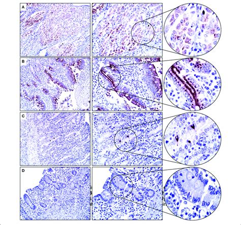 Glandular Stomach And Intestinal Tract A Gastric Mucosal