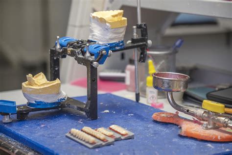 Dentures In Hamilton Nz Hamilton Dental And Prosthetic Lab