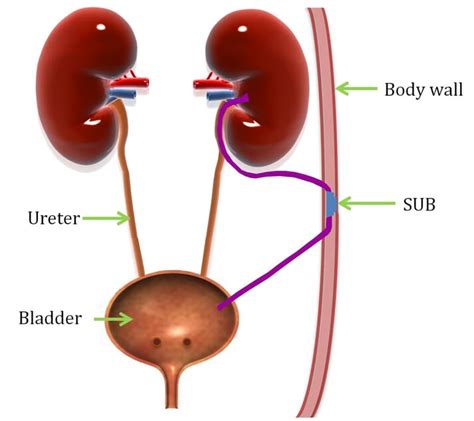 Treating Feline Ureteral Obstruction Veterinary Practice