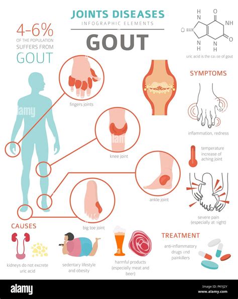 Enfermedades De Las Articulaciones Los S Ntomas De La Gota El