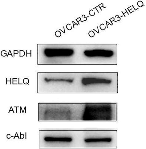 Helicase Polq Like Helq As A Novel Indicator Of Platinum Based