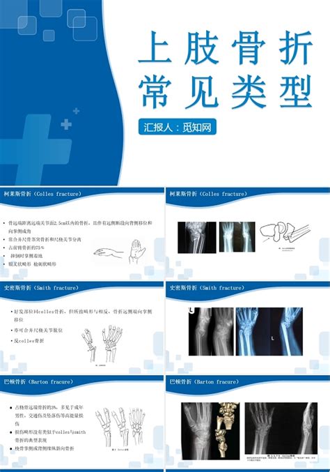 上肢ppt 上肢ppt模板下载 觅知网