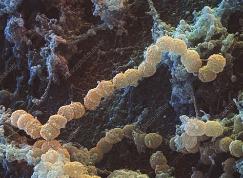 Strep Throat Bacteria Under Microscope