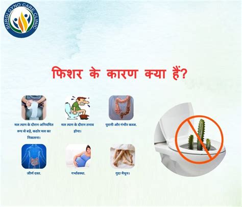 What Is Anal Fissure Best Piles Treatment In Agra