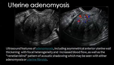 Pin On Imaging Radiology Pelvis