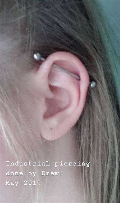 My Industrial Piercing Was Still Very Swollen Here