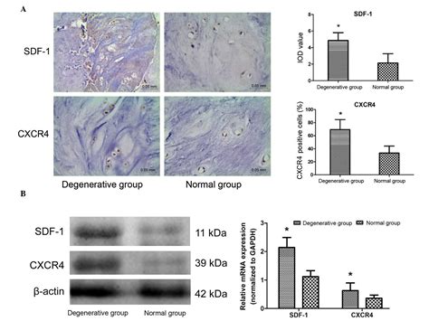 Sdf Cxcr Axis Induces Apoptosis Of Human Degenerative Nucleus