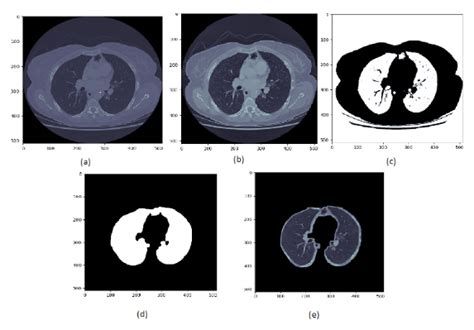 GitHub Yashika03 Lung Nodule Segmentation Using Squeeze And