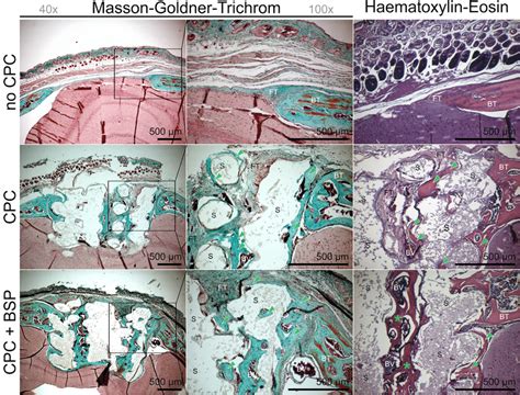 Masson Goldner Trichrom MGT And Hematoxylin Eosin HE Stainings