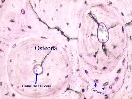 Bienvenido al blog de biología humana de Cristina y Miriam: Observación del tejido óseo.