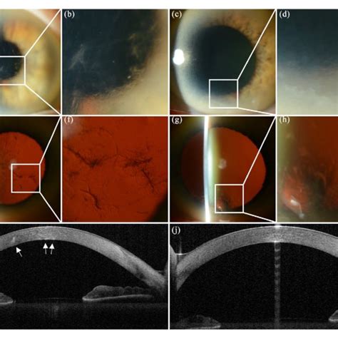 Anterior Segment Photography And Optical Coherence Topography As Oct Download Scientific