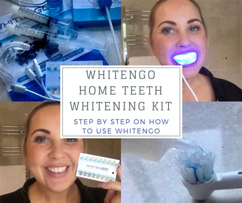 Home Teeth Whitening Kits Do They Work