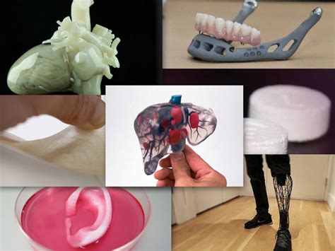 Aplicaciones Innovadoras Impresión 3d En La Medicina Sobre Impresoras 3d