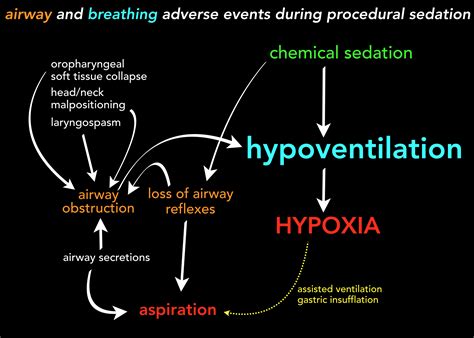 Procedural Sedation In Adults