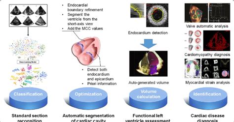 Application Of Artificial Intelligence In Echocardiography 12 15