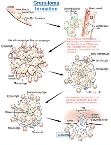 Immunology Immunity To Microbes Flashcards Quizlet